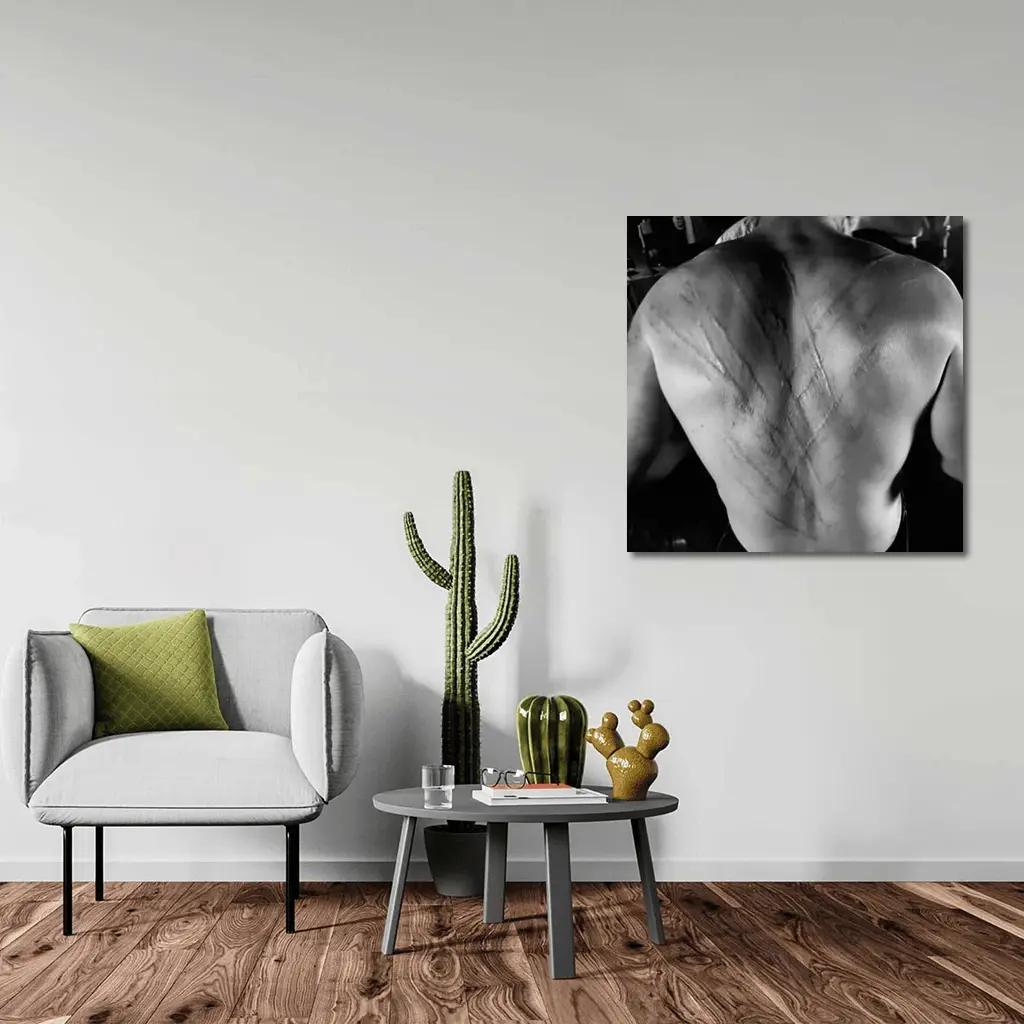 Scarred Male Back Black White Photography – Wall Art