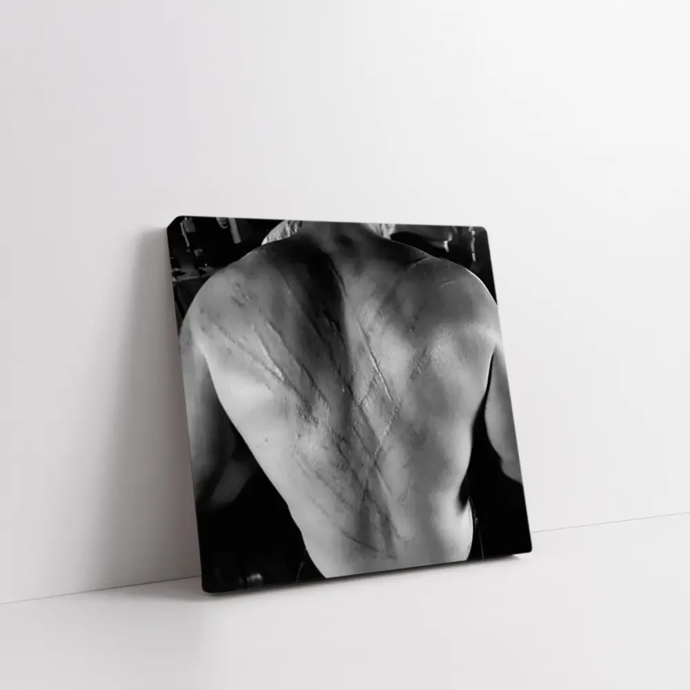 Scarred Male Back Black White Photography – Wall Art