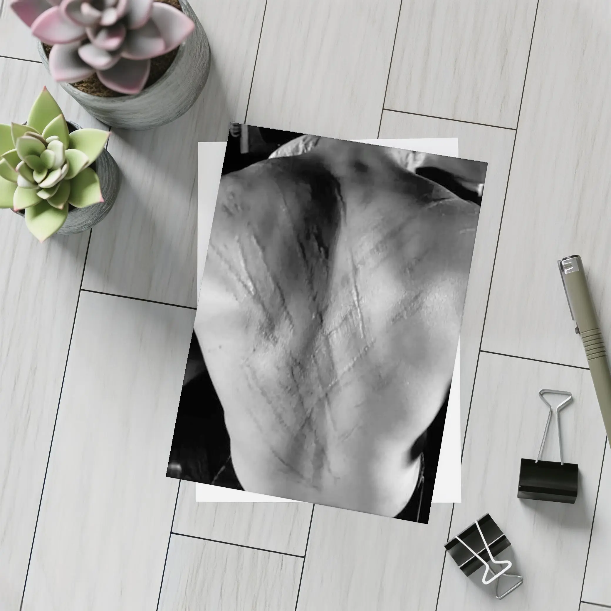 Scarred Male Back Black White Photography – Postcards