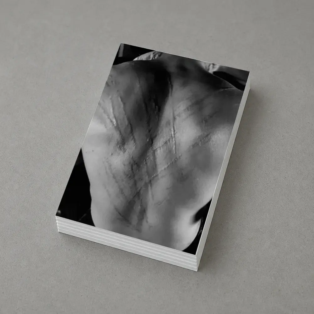 Scarred Male Back Black White Photography – Postcards