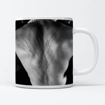 Scarred Male Back Black White Photography