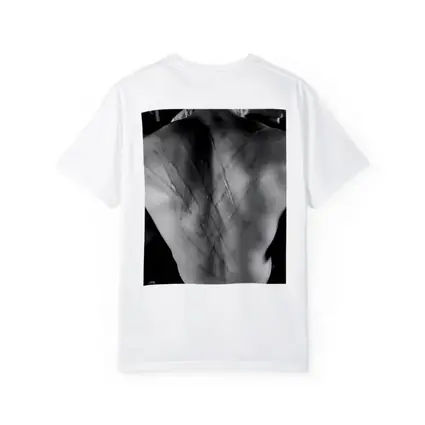 Scarred Male Back Black White Photography